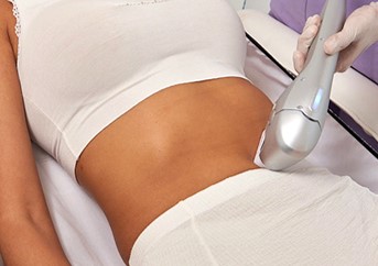 hifu en abdomen, cintura y piernas 3