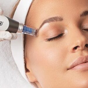 dermapen facial