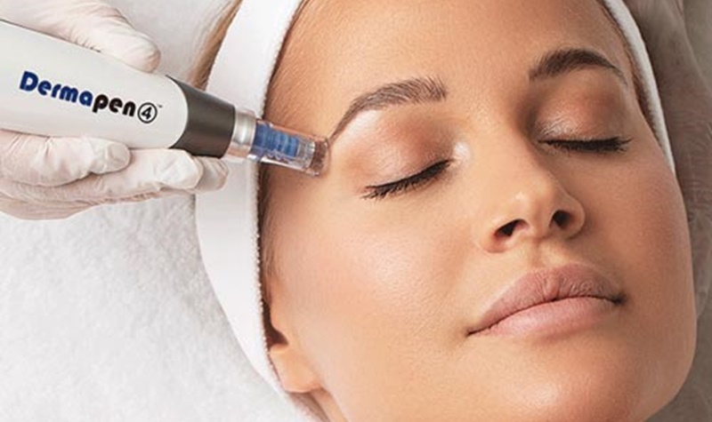 dermapen facial