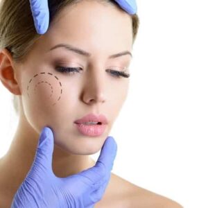 Higiene profunda + dermapen con peptonas 1