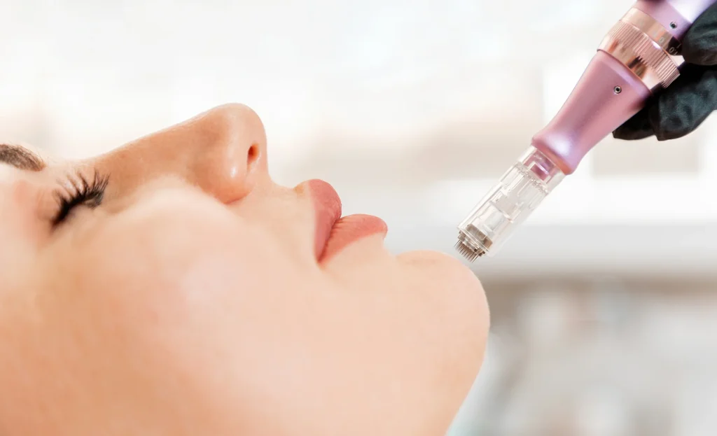 Higiene profunda + dermapen facial con peptonas 2