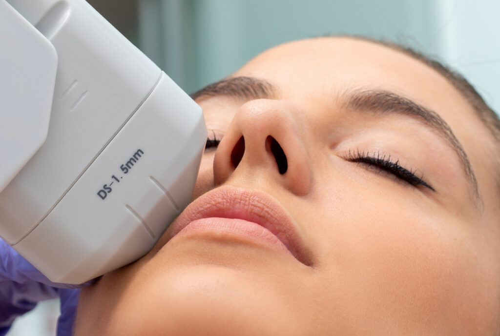 hifu facial + cuello + escote 3