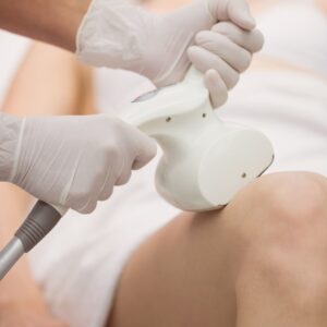 Crio radiofrecuencia