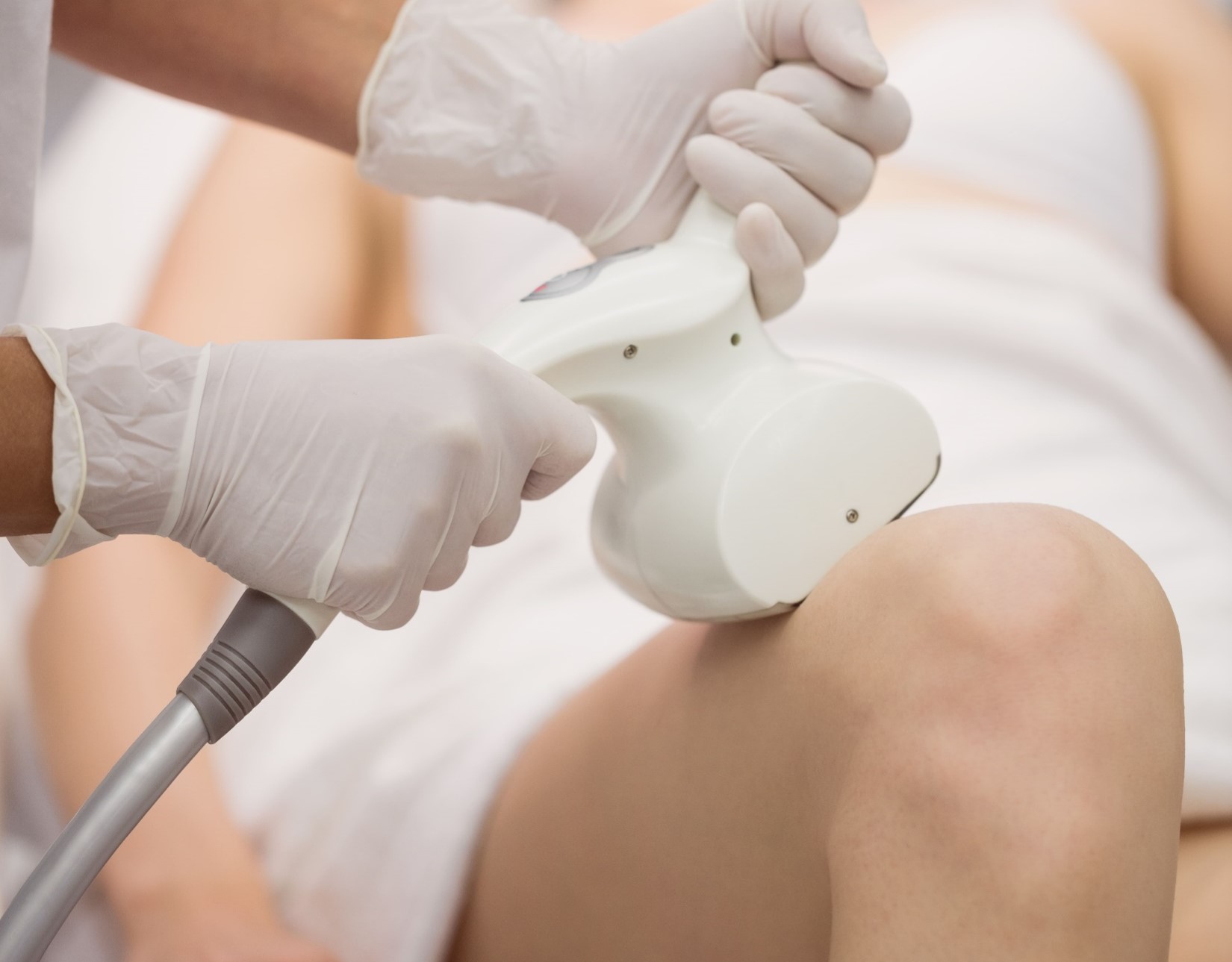 Crio radiofrecuencia