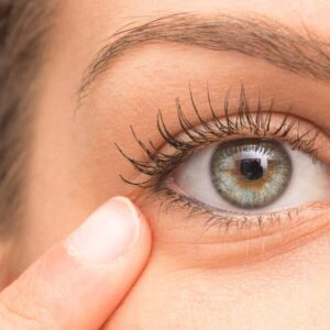 Microneedling para lifting de ojos