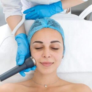 Radiofrecuencia fraccionada con activos europeos