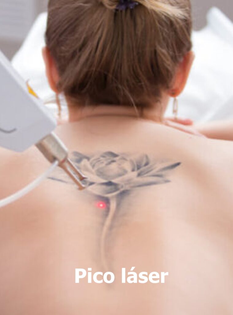 El tratamiento con pico láser trata manchas, melasma, arrugas, poros dilatados, cicatrices de acné, rosácea, estrías, hiperpigmentación, marcas de nacimiento, tatuajes y daño solar en rostro, cuello, espalda, escote, manos y otras partes del cuerpo donde se presenten imperfecciones.
