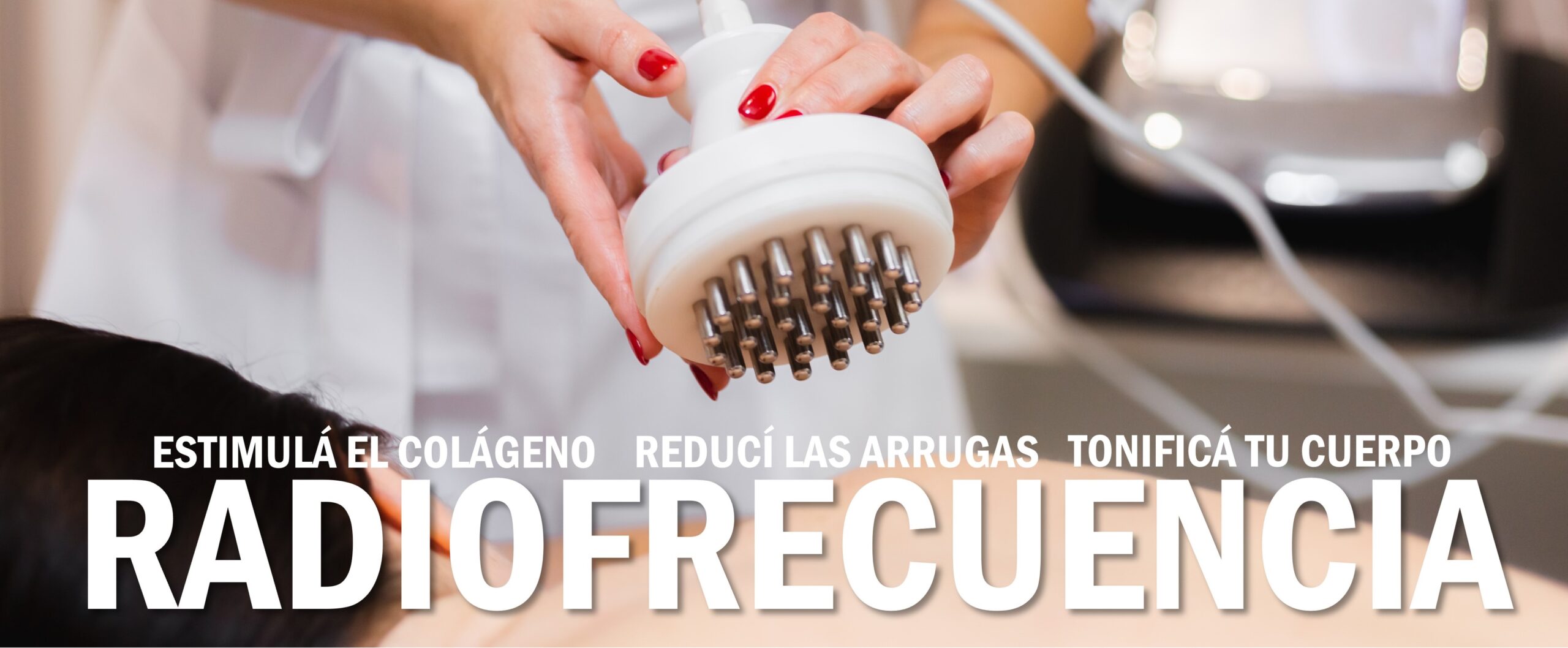 La radiofrecuencia fraccionada es una tecnología no invasiva que utiliza ondas de radiofrecuencia para estimular la producción de colágeno y elastina en la piel.